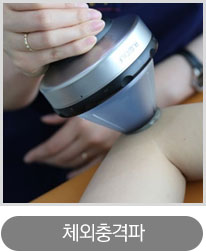 충격파