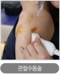 관절수동술